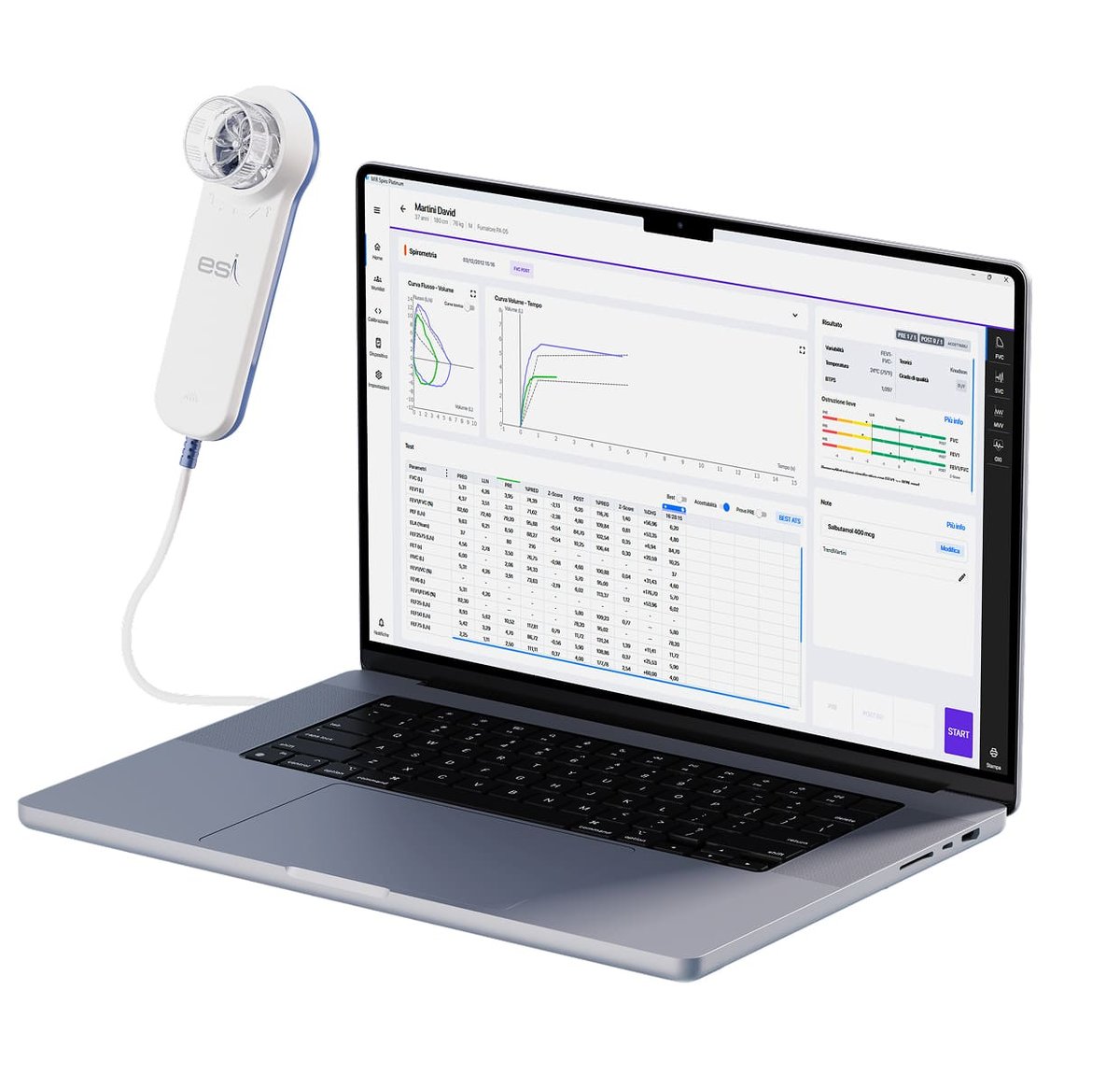 MINISPIR_PLUS_ESI-6.width-1200.jpg